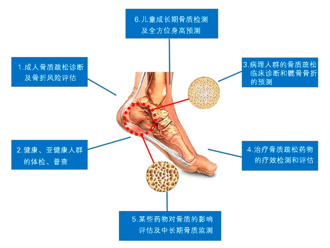 超声骨密度仪功能领域