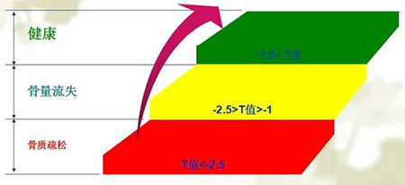 骨密度检测仪