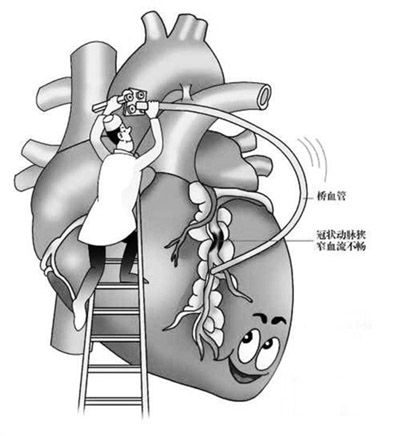 超声骨密度测试仪